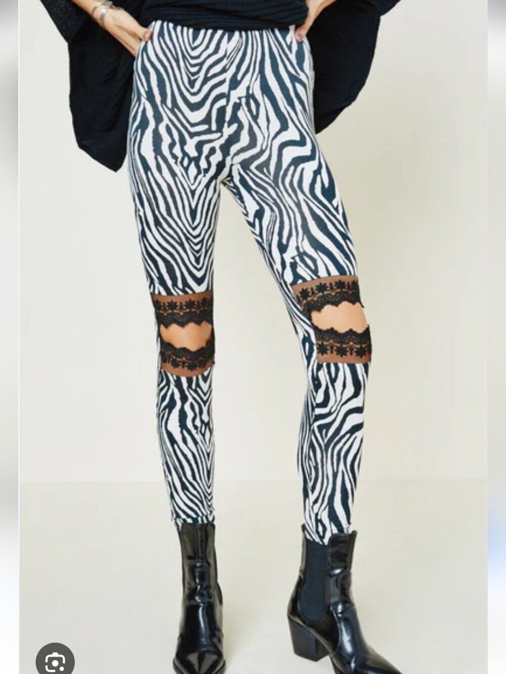Hayden Zebra Print Lace-Cutout Leggings - Black & White